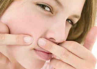 成人痘问题应该如何解决 成人痘怎么办