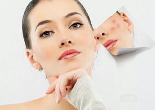 青春期祛痘不能远离的食物（青春痘食物禁忌）