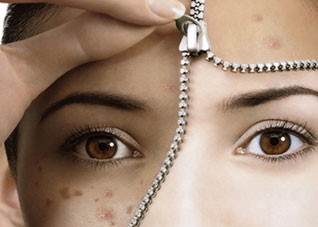 关于脸颊两侧长痘的原因全解 脸颊两侧长痘的原因引起的