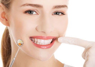 牙齿美白应注意哪些误区 牙齿美白应注意哪些误区图片