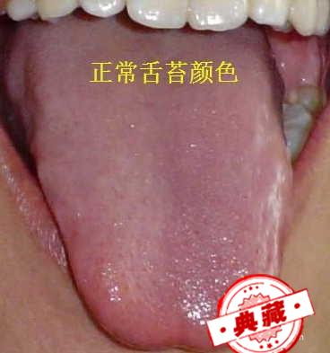 儿童感冒的简单诊断和治疗（儿童感冒的简单诊断和治疗流程）