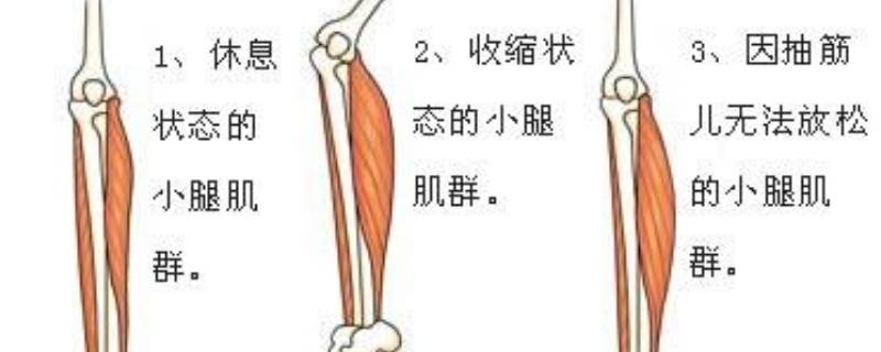 痉挛怎么读 痉挛怎么读音同音字