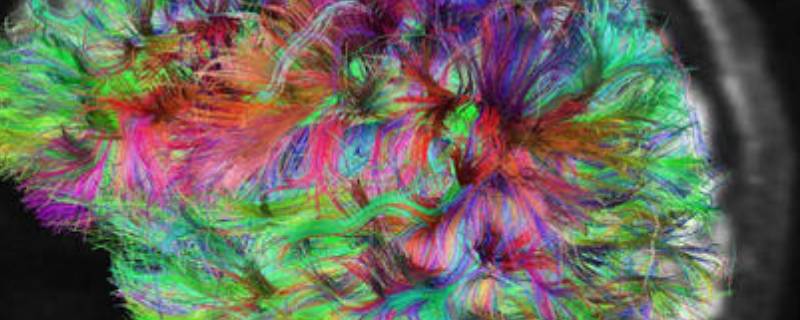 脑回路太短是什么意思 脑回路长短