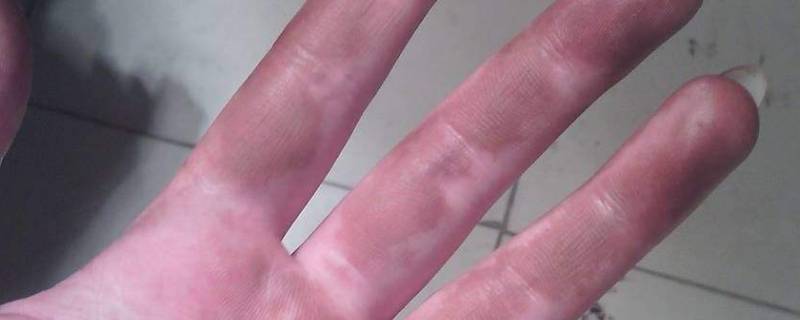 笔油弄到手上怎么洗（中性笔油弄到手上怎么洗）