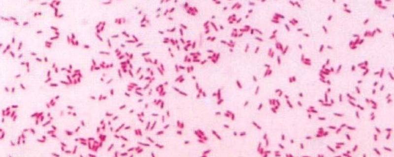 革兰氏染色注意事项 革兰氏染色注意事项有哪些