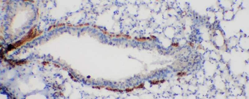 石蜡切片透腊叶片出现斑点 白蜡叶片边缘干枯