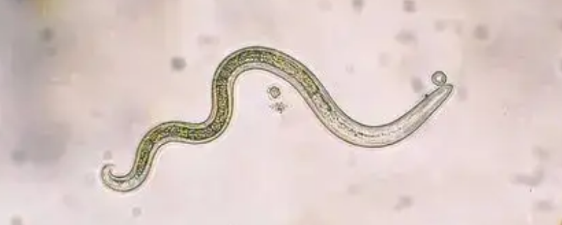 消防用水有弓形虫吗（消防用水有弓形虫吗为什么）