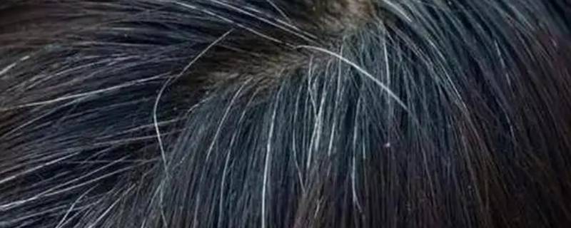 白发斑驳是什么意思 须发斑白是什么意思