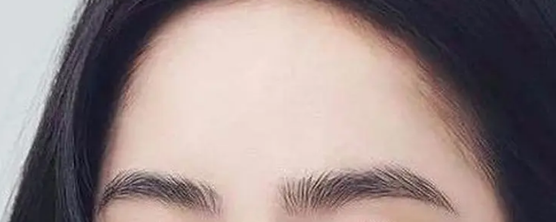 提眉后为什么变难看了 提眉后真的感觉老了