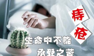 痔疮怎样治疗 肛门痔疮怎样治疗
