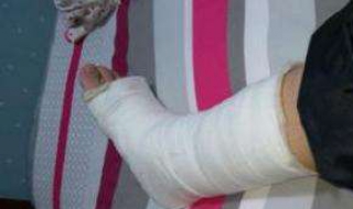 骨折病人吃什么好（骨折病人吃什么好得快）