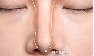 鼻子扁平怎么办 鼻子扁平怎么办才能变圆