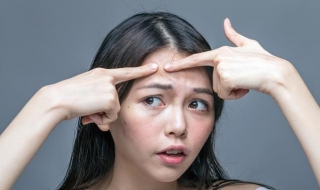 额头长痘痘了怎么办（额头长痘痘了怎么办?怎么快速祛痘?）