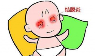 结膜炎怎么办（小孩结膜炎怎么办）