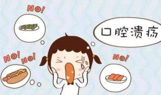 口腔溃疡怎么治才好（口腔溃疡如何治疗）