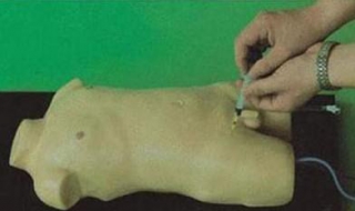 执业医师技能考试：动脉穿刺术（动脉穿刺成功的要点）