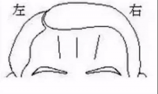 有川字纹怎么办（女人有川字纹怎么办）