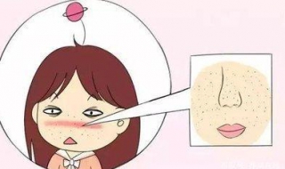 毛孔变粗怎么办 毛孔变粗大解决方法