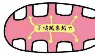 牙缝太大怎么办（门牙牙缝太大怎么办）