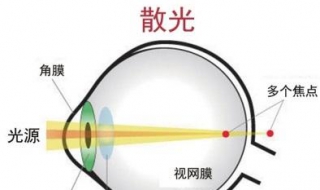 散光怎么办（散光怎么办能恢复吗）