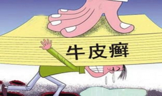 牛皮癣怎么办（牛皮有癣用什么药膏好得快一点）