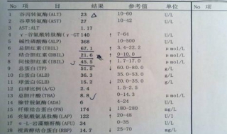 总胆红素偏高怎么办 总胆红素偏高怎么调理