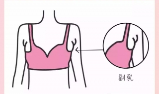 副乳怎么办（副乳怎么办怎么消除）