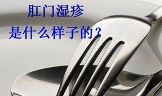 肛门湿疹怎么办 肛周湿疹怎么才能根除