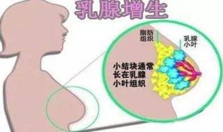 有了乳腺增生怎么办（有了乳腺增生怎么办才能消除）