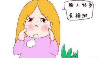 脸部黄褐斑怎么办（脸部黄褐斑怎么办能去掉吗）