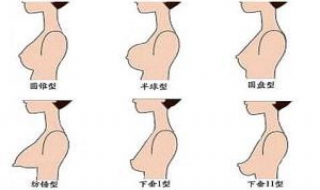 胸部下垂怎么办 胸部下垂有什么好办法可以提升
