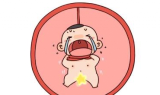脐带绕颈怎么办 脐带绕颈2圈怎么办