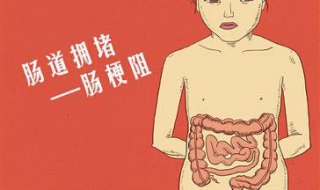 肠梗阻怎么办 肠道梗阻怎么治疗