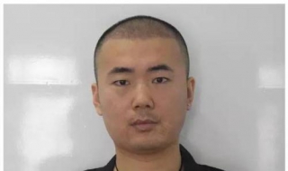 秃顶怎么办 快秃顶了怎么办