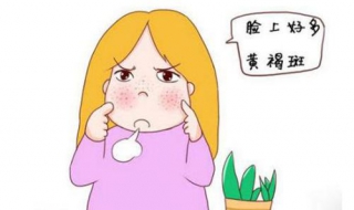 女人脸上长黄褐斑怎么办（女人脸上长黄褐斑是什么原因引起的）