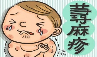 得了荨麻疹怎么办 为什么会得荨麻疹