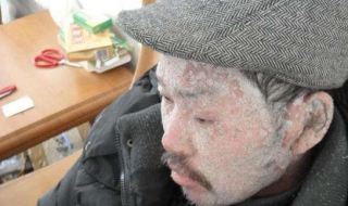 有牛皮怎么办 牛皮怎么办好