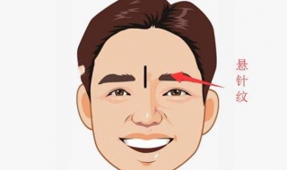 有悬针纹怎么办 有悬针纹怎么去除