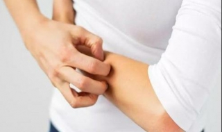 冬季皮肤瘙痒怎么办（秋冬季节皮肤瘙痒怎么办）