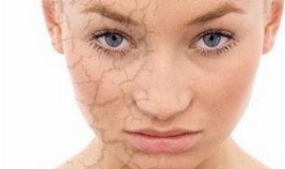 全身皮肤粗糙怎么办 全身皮肤粗糙如何改善