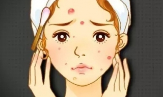 激光祛痘注意事项（做完激光祛痘后注意事项）