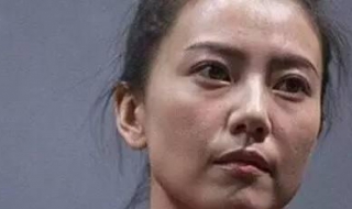 下眼袋浮肿怎么办 右下眼袋浮肿是什么原因