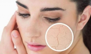 脸皮肤松弛怎么办（脸皮肤松弛是什么原因造成的）