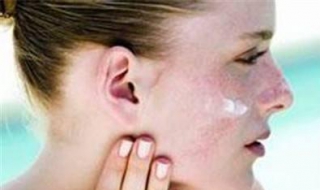 秋季皮肤过敏怎么办 秋季皮肤过敏怎么办啊