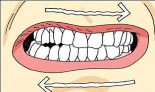 磨牙怎么办 磨牙怎么办 成人