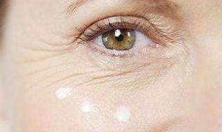 眼部皱纹多怎么办（眼部皱纹多怎么办小妙招）