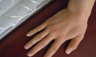 手上起湿疹怎么办 手上起湿疹怎么根治