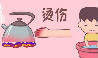 宝宝烫伤怎么办（被暖宝宝烫伤怎么办）