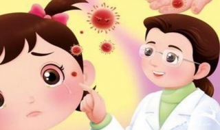 红眼病注意事项 红眼病是怎么回事