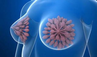 乳腺增生怎么办（乳腺增生怎么办才好）